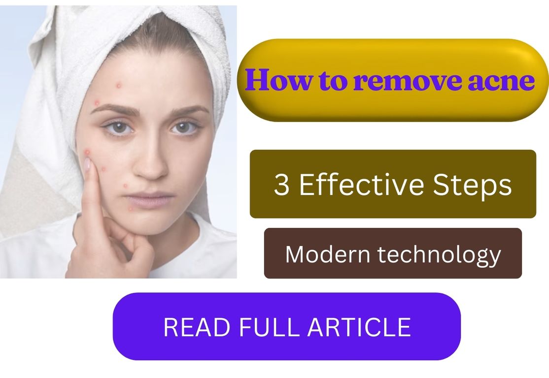 how to remove acne