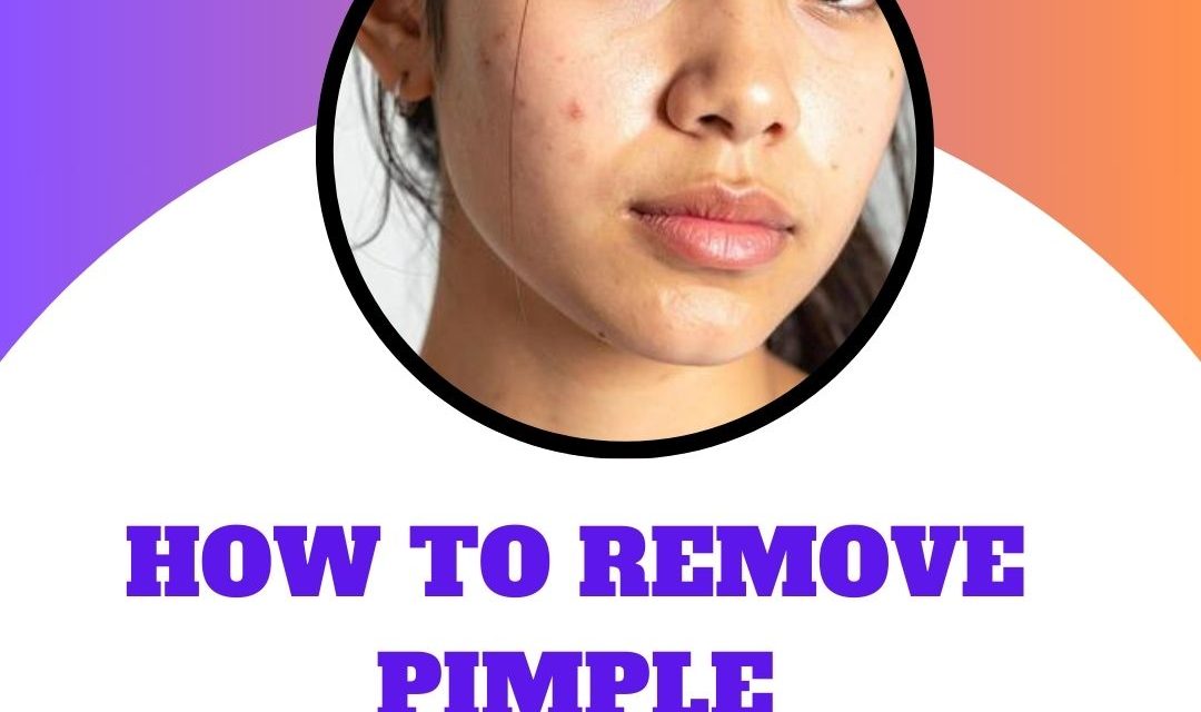How to remove pimple