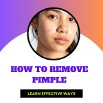 How to remove pimple